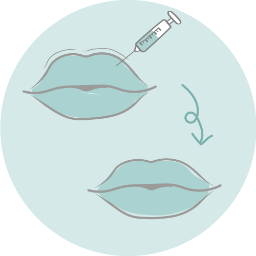 Hyalase (correctie van foutieve fillers) 