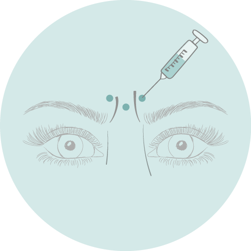Botox behandeling (verschillende zones)