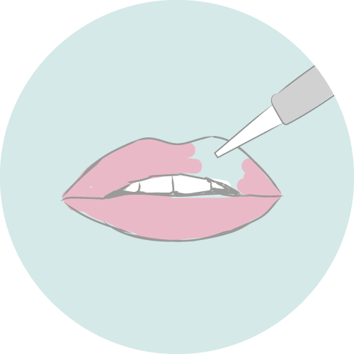 Pico Laser Removal Lips