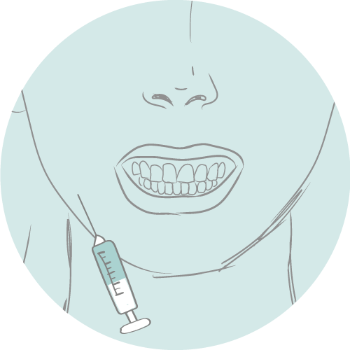 BTX Tandknarsen/bruxisme