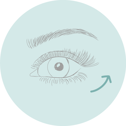 HIFU eyes