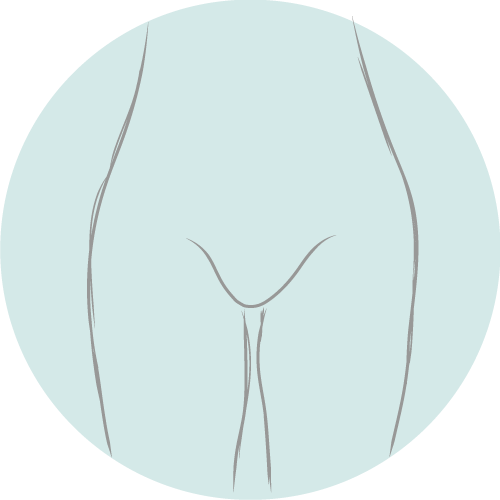 HIFU Vagina